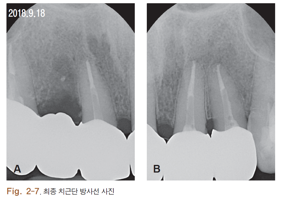 HSMCB1_2018_v27n1_4_f0011.png 이미지