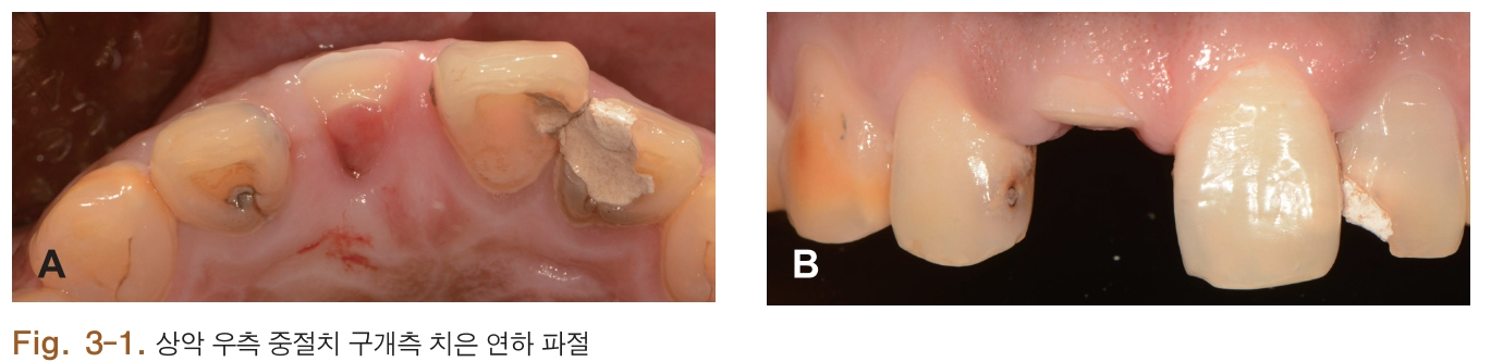 HSMCB1_2018_v27n1_4_f0012.png 이미지