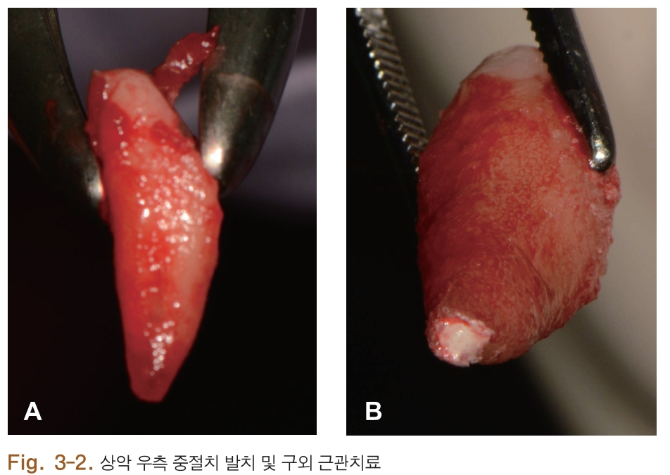 HSMCB1_2018_v27n1_4_f0013.png 이미지