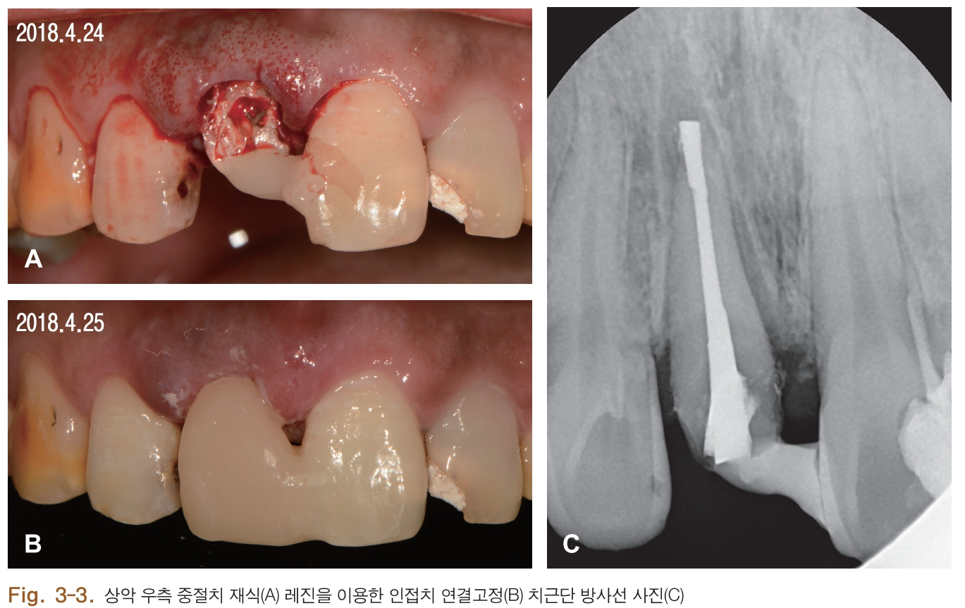 HSMCB1_2018_v27n1_4_f0014.png 이미지