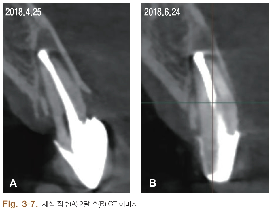 HSMCB1_2018_v27n1_4_f0018.png 이미지