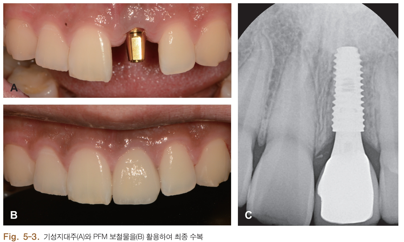 HSMCB1_2018_v27n1_4_f0025.png 이미지