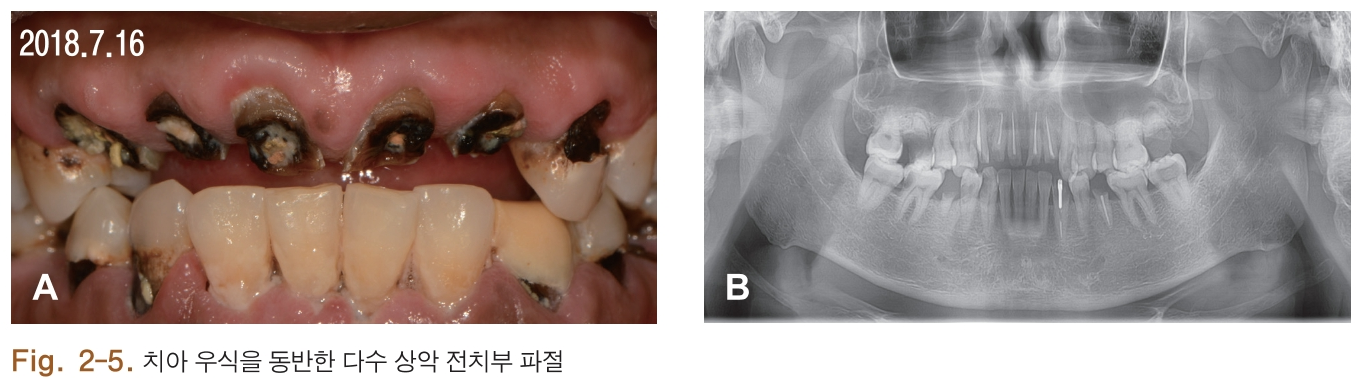 HSMCB1_2018_v27n1_4_f0009.png 이미지