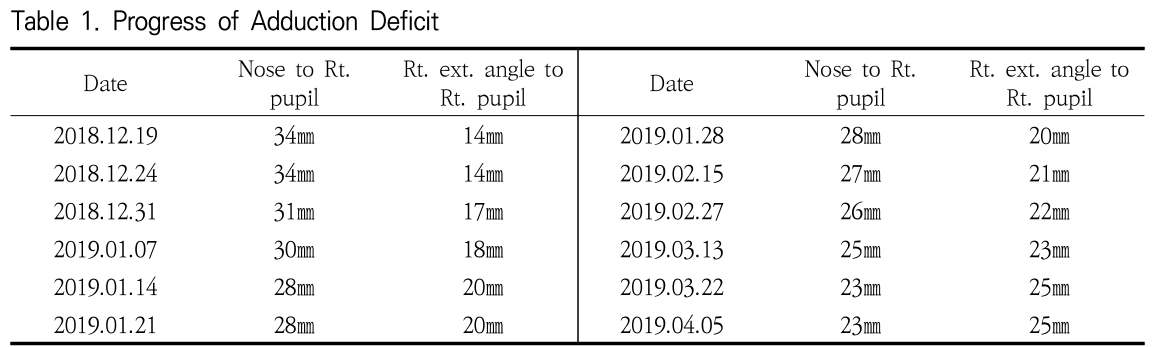 OOBHC1_2019_v32n2_120_t0001.png 이미지