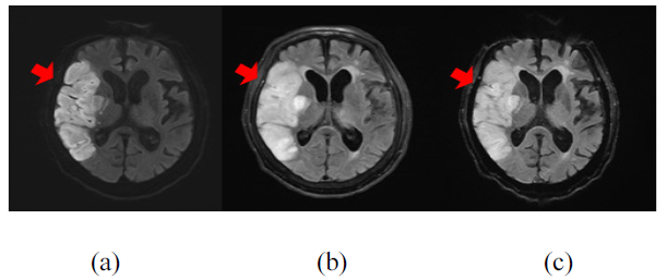 BSSHB5_2020_v14n7_957_f0005.png 이미지