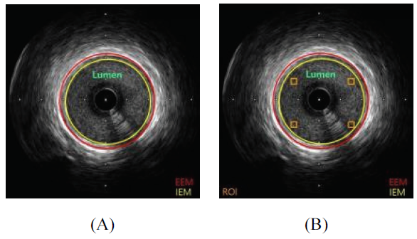 BSSHB5_2021_v15n5_621_f0006.png 이미지