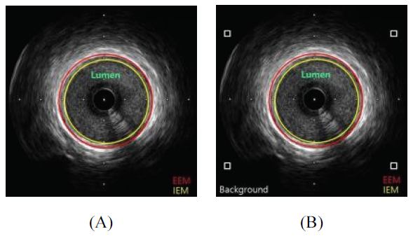 BSSHB5_2021_v15n5_621_f0008.png 이미지